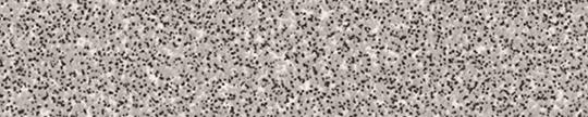 Formica 09300 Gray Grafix Edgebanding Crossgrain Match