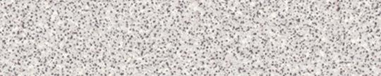 Formica 00507 Folkstone Grafix Edgebanding Crossgrain Match